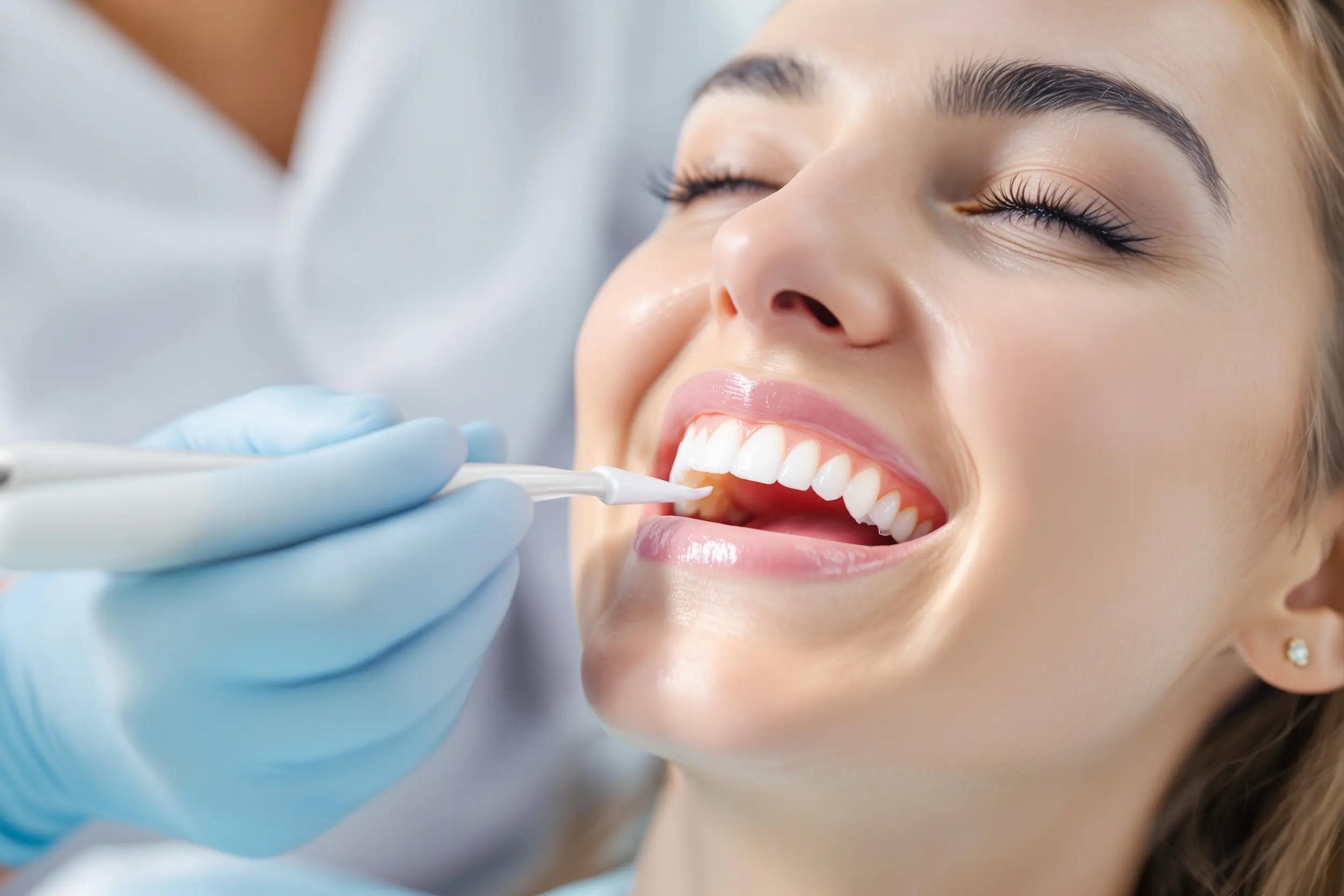 Tratamiento estético dental